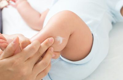 Eczéma chez l'enfant : comment soulager les symptômes ?