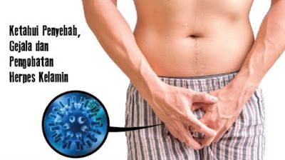 Obat Penyakit Herpes Kelamin Cepat Sembuh