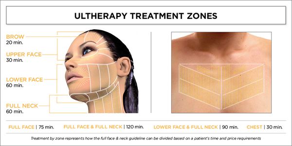 Ultherapy deux ans après