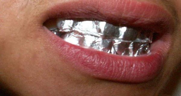 Conseil utile! Savez-vous ce qui se passera si vous gardez de papier d'aluminium sur vos dents pendant 1 heure?