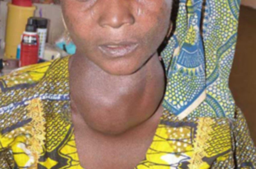 prostituée ethiopienne