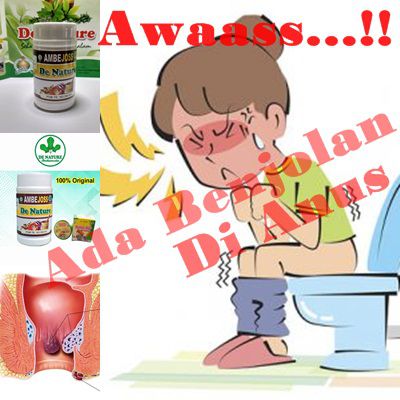 Obat BAB Keluar Darah Paling Ampuh Gejala Ambeien