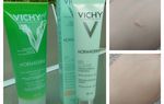 Test Vichy Normaderm (BB Cream/nettoyant)