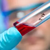 Sang d'enfants et adrénochrome : la parabiose hétérochronique est une pratique de gens riches - Strategika