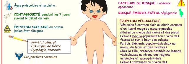Maladie pieds/mains/bouche