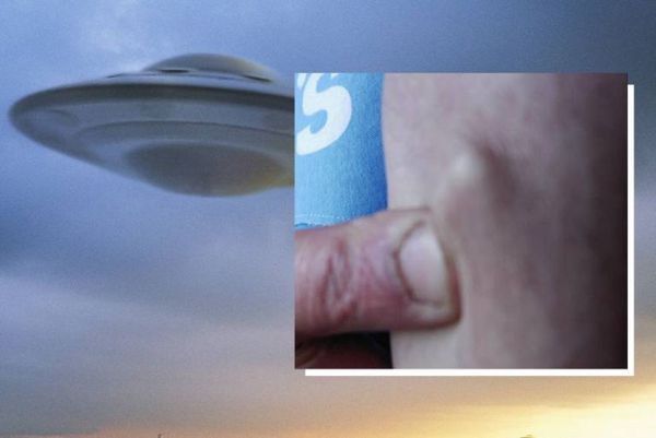 Steve Munday enlevé par des extraterrestres