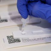 Strasbourg : un collectif dénonce les tests PCR toujours obligatoires dans certains établissements de santé