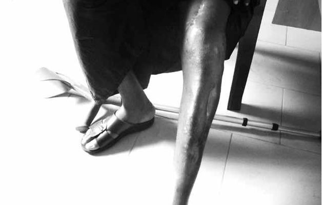 Usage de tortures en Guinée-Conakry ( Rapport ONG )