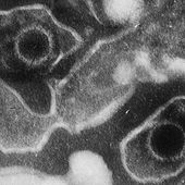 Black sheep: Why some strains of the Epstein-Barr virus cause cancer