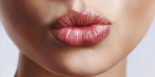 Vos lèvres sont sèches ou gercées que faire ?