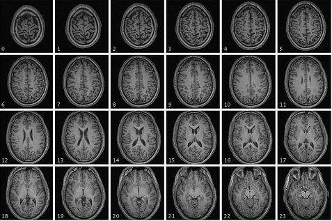 Neurosciences