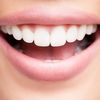 Les meilleurs astuces pour des dents plus blanches