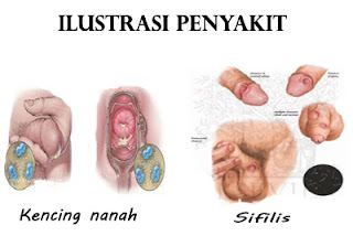 obat sipilis herbal paling ampuh sembuh total