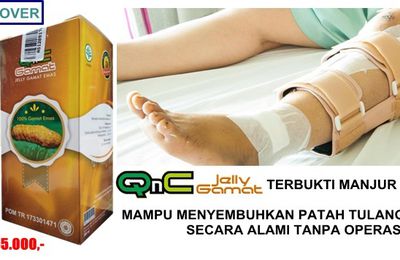 Obat Patah Tulang Di Apotik Paling Ampuh