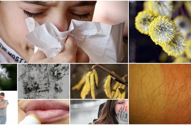 Adiós a las alergias estacionales: Descubra remedios naturales efectivos