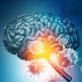 COVID-19 activates similar response to Parkinson's disease, study suggests