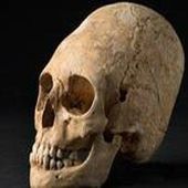 [INSOLITE] Un crâne étonnamment déformé découvert sur un site en Alsace - Stratégie du chaos...