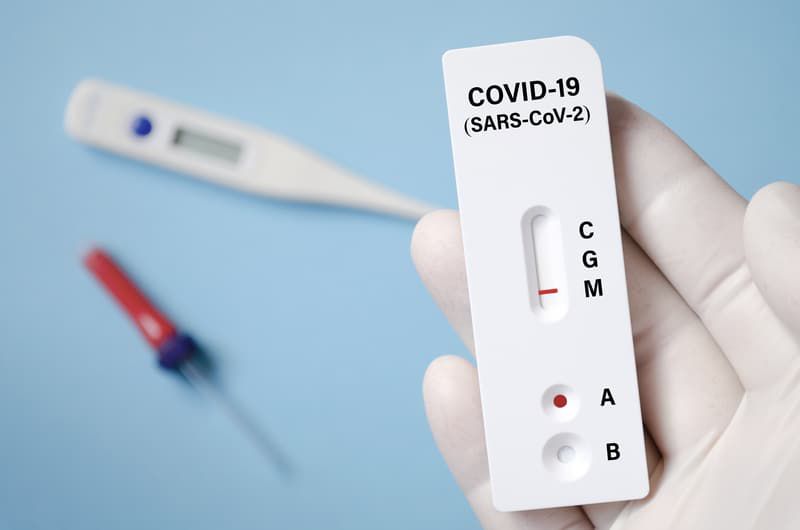 Covid-19. Tests de anticuerpos COVID: engaños y falsificaciones. La capacidad de manipular el significado de los resultados es infinita