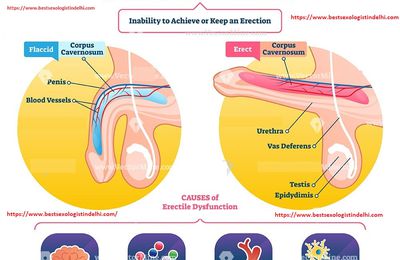 Best Sexologist Dr. Vinod Raina for Treatment of Erectile Dysfunction in Delhi 