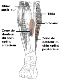 Mal au muscle du tibia quand je cours