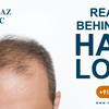 What are the reasons behind the Hair loss, know how you can cure it?
