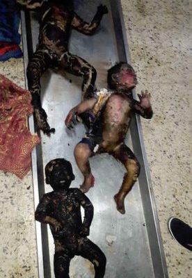 Le blocus de Gaza c’est ça ! Photo de 3 enfants brûlé