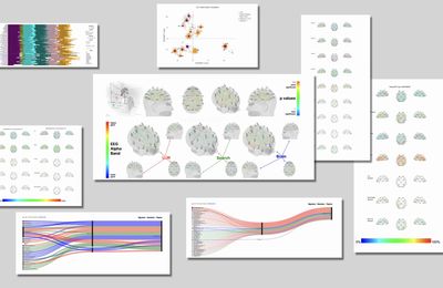 ChatGPT est-il en train de casser le cerveau humain ? 5 points sur l'alarmante étude du MIT sur les effets de l'IA | Le Grand Continent