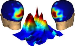 Attention et conscience : des mécanismes cérébraux distincts
