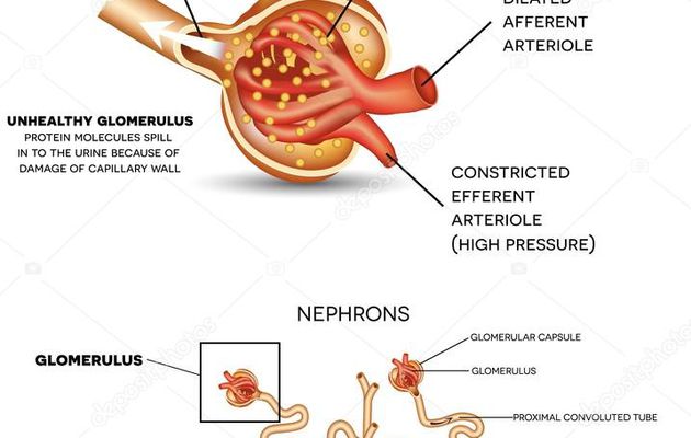 Diabete rein symptome