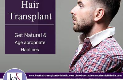 Hair Transplant Surgery - How Long It Takes To See The Hair Growth?