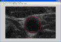File:Ultrasound-Common-Carotid-Artery-Segmentation-Based-on-Active-Shape-Model-345968.f2.ogv - Wikimedia Commons