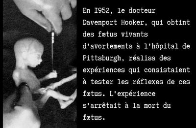Expérimentations du Dr Davenport Hooker (université de Pittsburgh), en 1952 sur des foetus vivants