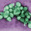 Premier cas de H1N1 pour l'Afrique du sud