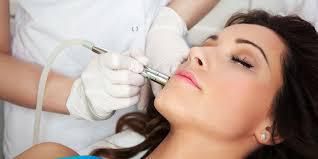 Basics of Laser Treatments for Acne