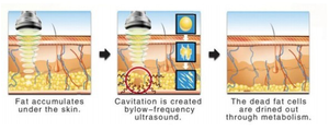 Why the Ultrasonic Cavitation Equipment is Most Suitable for Slimming