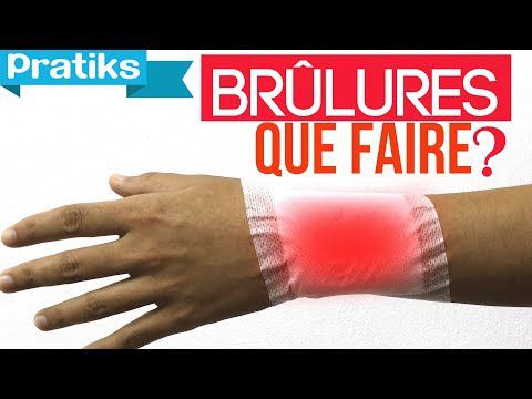 Les bons gestes - Que faire en cas de brûlure ?