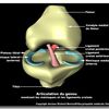 opération chirurgicale des ménisques