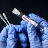 UNE BOMBE: AUX ÉTATS-UNIS LE CDC NE RECONNAÎT PLUS LE TEST PCR - pleinsfeux.org
