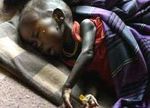 Un tiers de la population guinéenne souffre de la malnutrition
