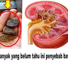 OBAT HERBAL PENGHANCUR BATU GINJAL ALAMI TERBAIK