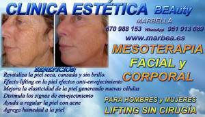 MESOTERAPIA FACIAL y CORPORAL en MARBELLA