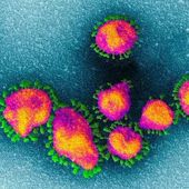 Des médecins du Hubei alertent sur une réinfection au coronavirus encore plus mortelle, provoquant des crises cardiaques soudaines | Aube Digitale