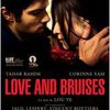 Love and Bruises