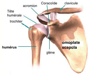 La luxation de l'épaule