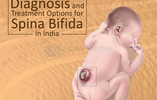 Diagnosis and Treatment Options for Spina Bifida in India