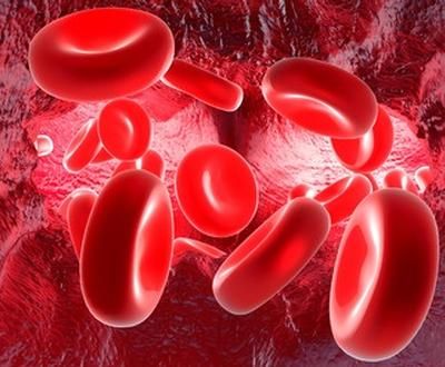 Fibromyalgie : une inflammation générale - juin 2017