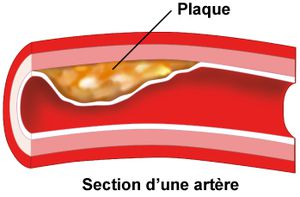 LE CHOLESTEROL