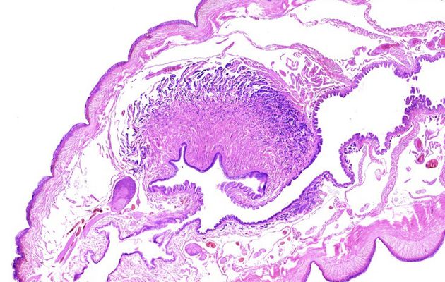 Un peu de physiologie animale : cas du Lombric commun, une Annélide oligochète 