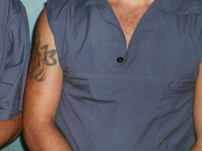 Cuba: Recluso contagiado de tuberculosis corre el riesgo de morir plantado