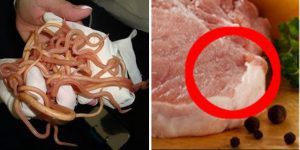 4 Risques sanitaires liés à l'alimentation des produits de porc